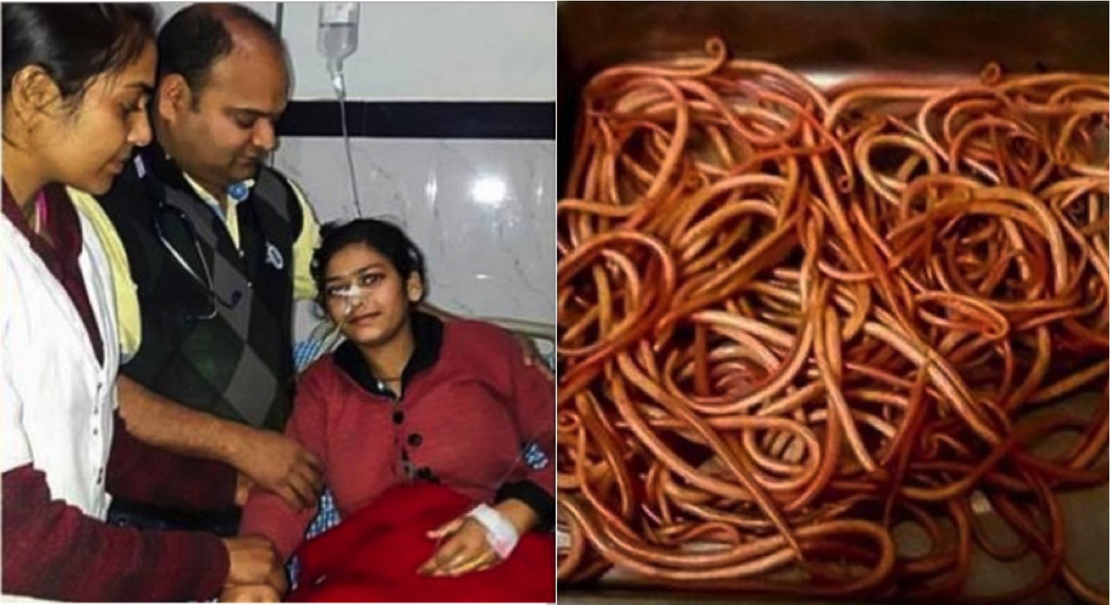 Gadis Sakit Perut Dan Muntah-muntah, Doktor Terperanjat Menemui 150 Cacing Ditemui Di Dalam Tubuhnya