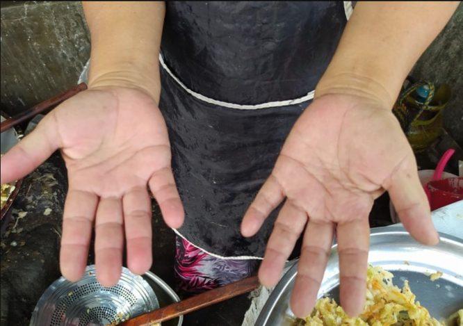Tidak Perlukan Senduk, Peniaga Wanita Cuma Guna Tangan Celup Minyak Panas Ketika Menggoreng 
